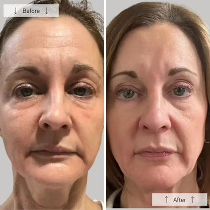 RegenLED Contour Mask