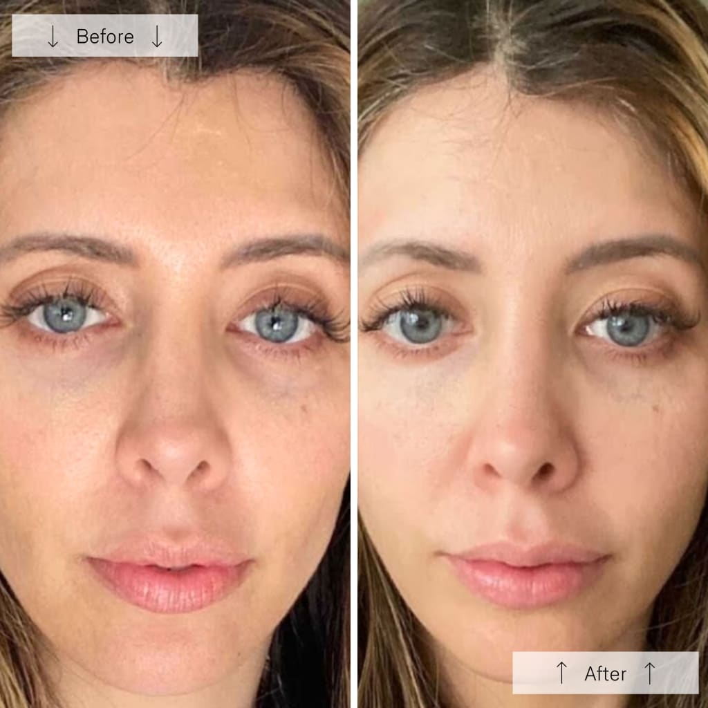 RegenLED Contour Mask