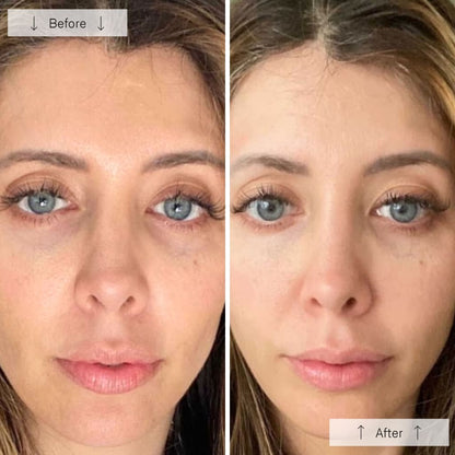 RegenLED Contour Mask