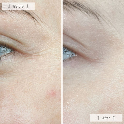 RegenLED Contour Mask
